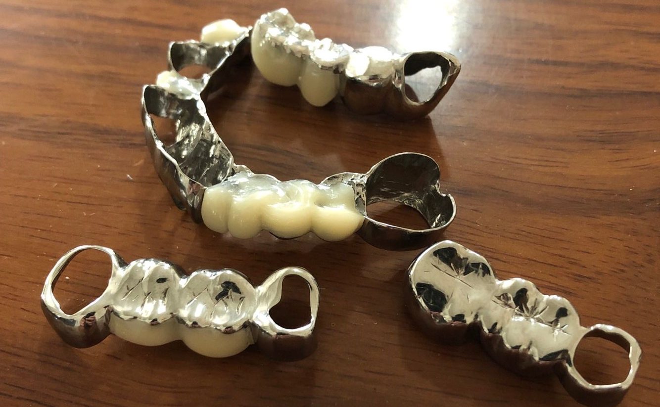 dental parts before and after polishing
